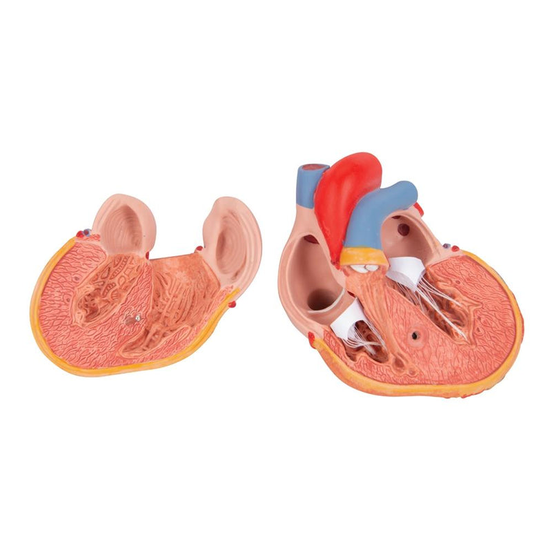 Classic Heart Model with Left Ventricular Hypertrophy (LVH), 2 part