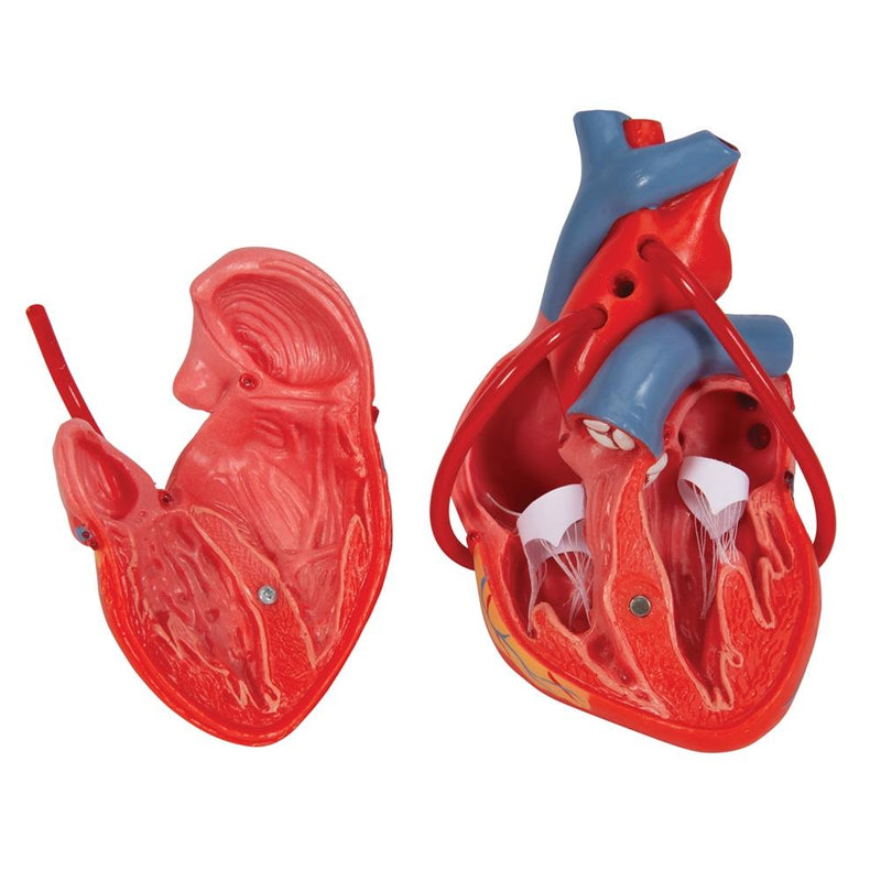 Classic Heart with Bypass, 2 part