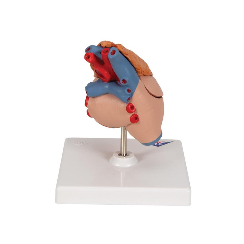 Classic Heart with Thymus, 3-part