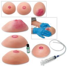 Common Breast Conditions, Set of 4