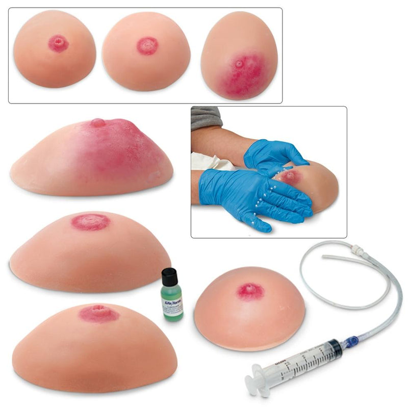 Common Breast Conditions, Set of 4 Common Breast Conditions, Set of 4