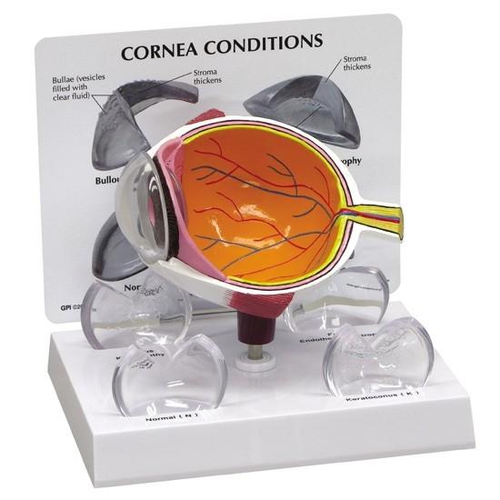 Cornea Eye Cross-Section Model