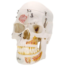 Deluxe Human Demonstration Dental Skull Model, 10 part