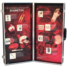 Diabetes Consequences 3D Display