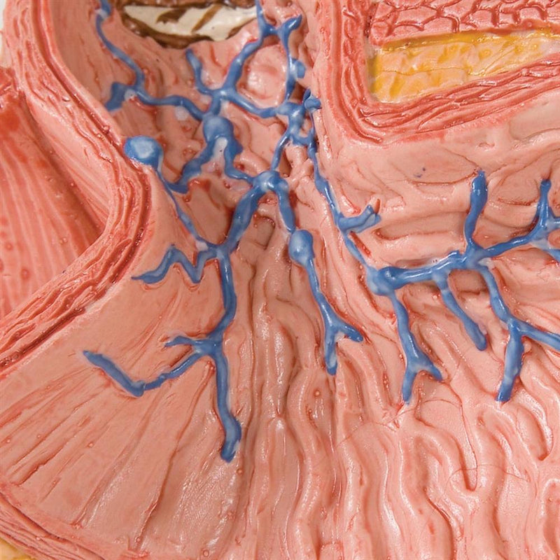 Diseases of the Esophagus Model