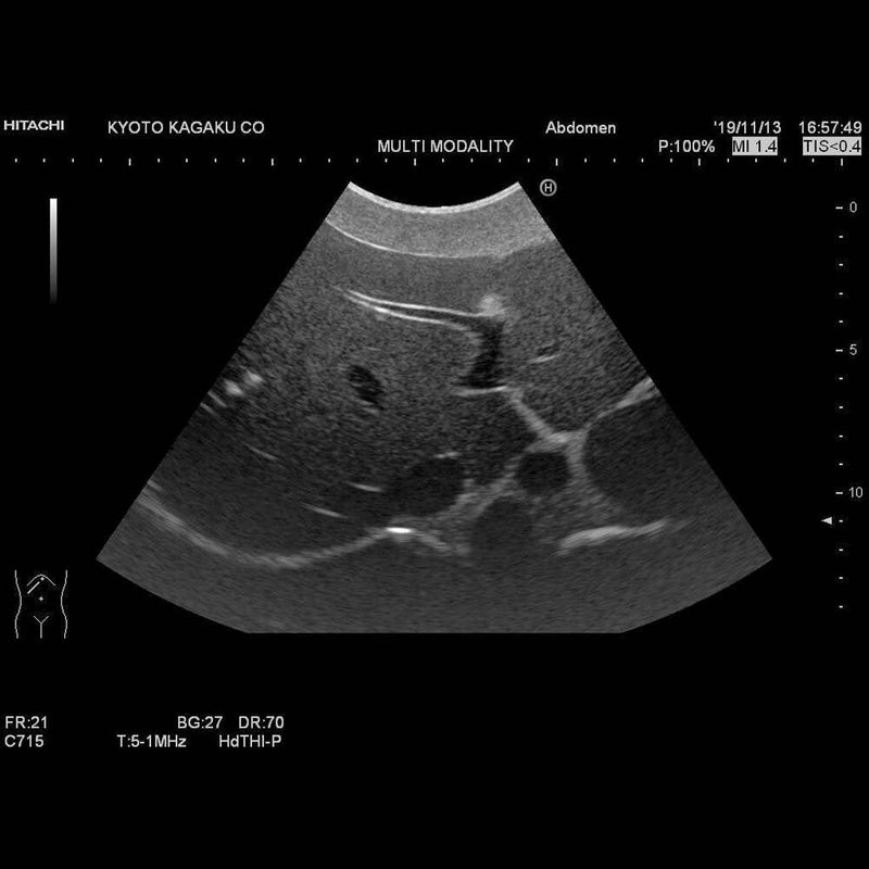 Dual Modality Human Abdomen Phantom (CT, Ultrasound)