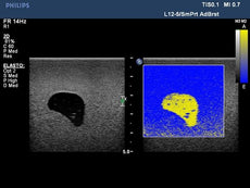 Biopsy and Elastography Ultrasound Training Model