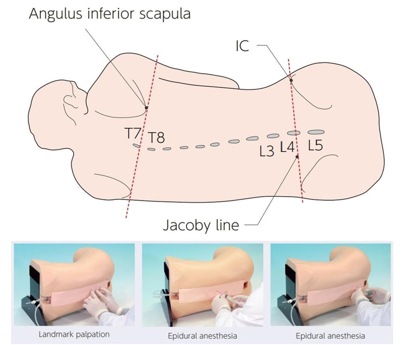 Simulators Anaesthesia Epidural Anesthesia Simulator | Kyoto Kagaku Epidural Anesthesia ...