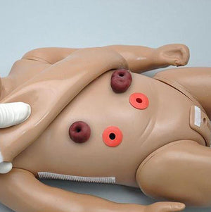 External Stoma Sites | Add-on option for S110