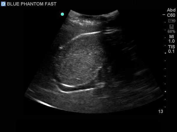 FAST Exam Real Time Ultrasound Training Model, Transthoracic Only ...
