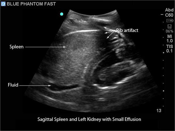 FAST Exam Real Time Ultrasound Training Model, Transthoracic Only ...