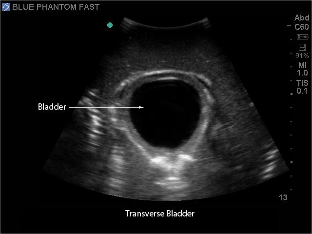 FAST Exam Real Time Ultrasound Training Model, Transthoracic Only