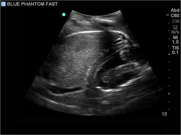 FAST Exam Real Time Ultrasound Training Model, Transthoracic Only ...