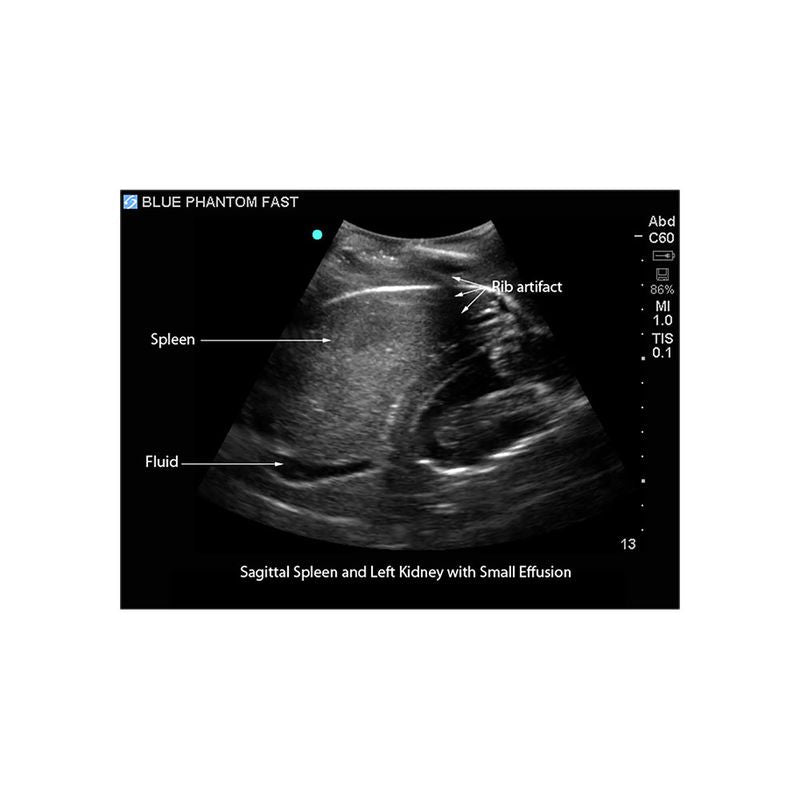 FAST Exam Ultrasound Training Model, Transthoracic and Transesophageal