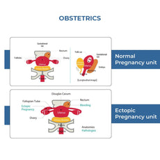 Female Pelvic Ultrasound Phantom (Transvaginal and Transabdominal) Obstetrics