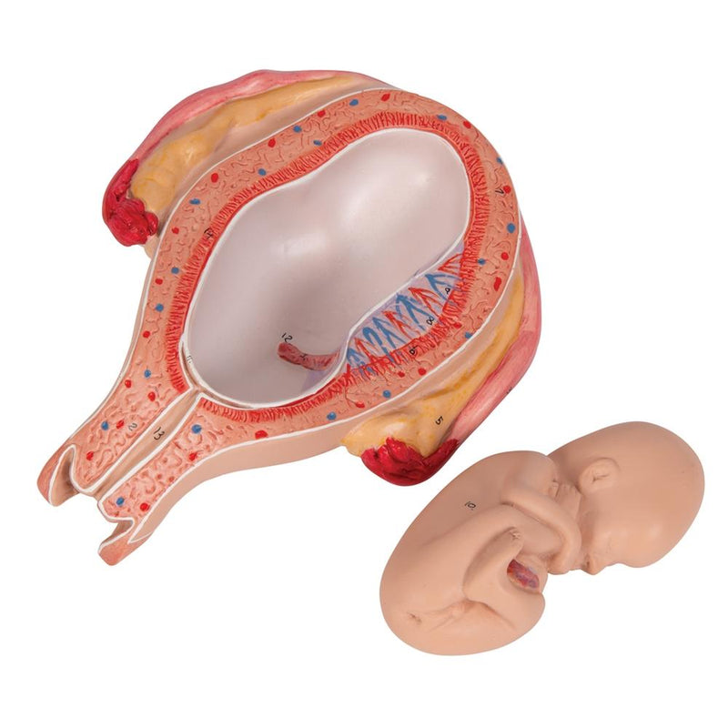 Fetus, Month 5, Breech Position