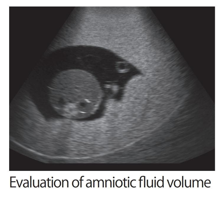 Fetus Ultrasound Exam Phantom SPACE FAN-ST