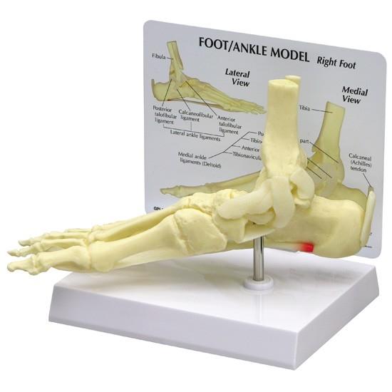 Foot-Ankle Model with Plantar Fasciitis
