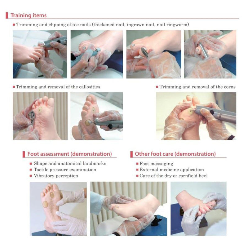 Foot Care Model with Nails and Callosities