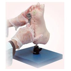 Foot Care Model with Nails and Callosities