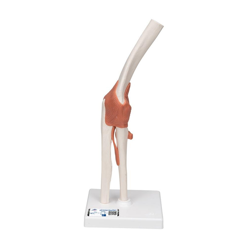 Functional Elbow Joint Model