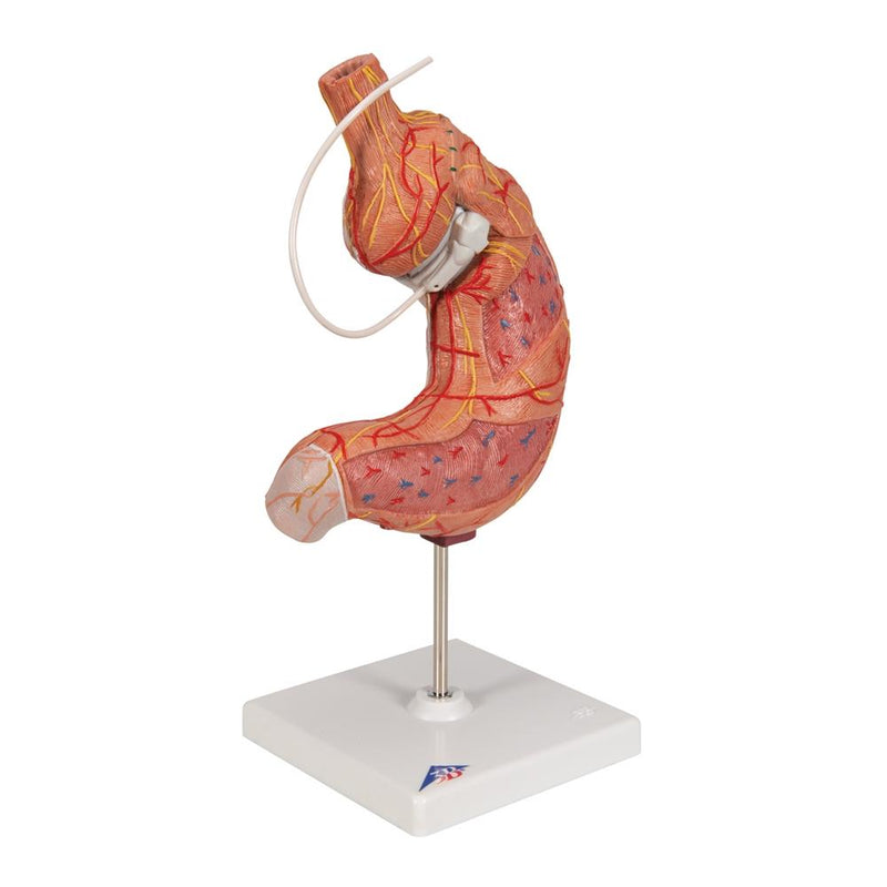 Gastric Band Model with SAGB Quick Close®