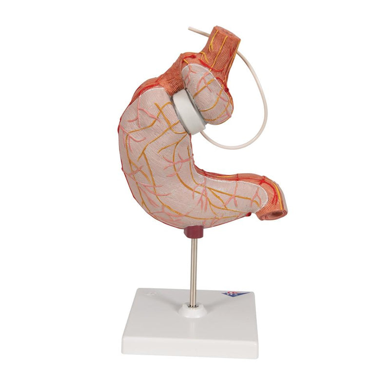 Gastric Band Model with SAGB Quick Close®