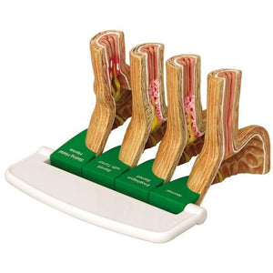 GastroEsophageal Reflux Disease Model (GERD)