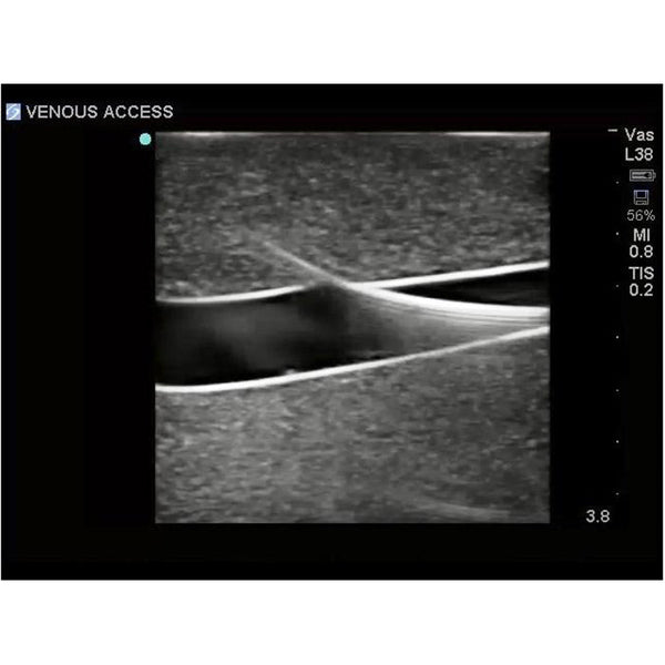 Gen II Ultrasound Central Line Training Model | CAE Blue Phantom ...