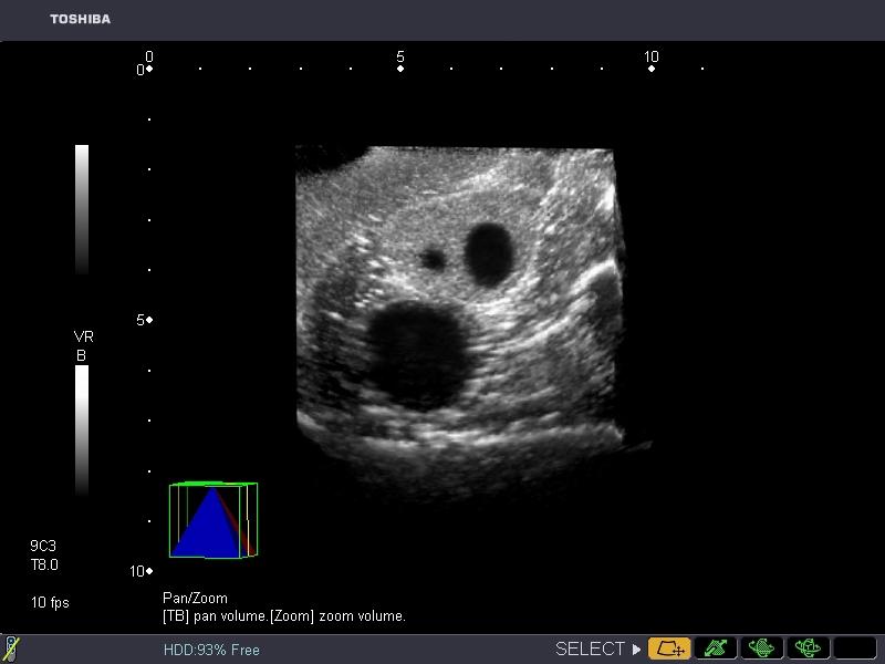 General Pathology Transvaginal Ultrasound Training