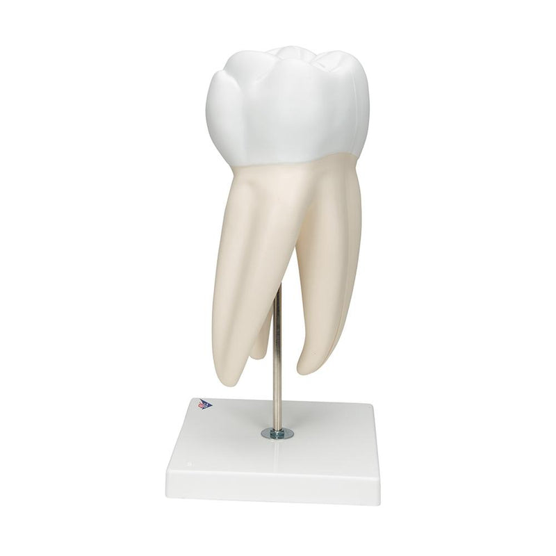 Giant Molar with Cavities, 15x life size, 5 part