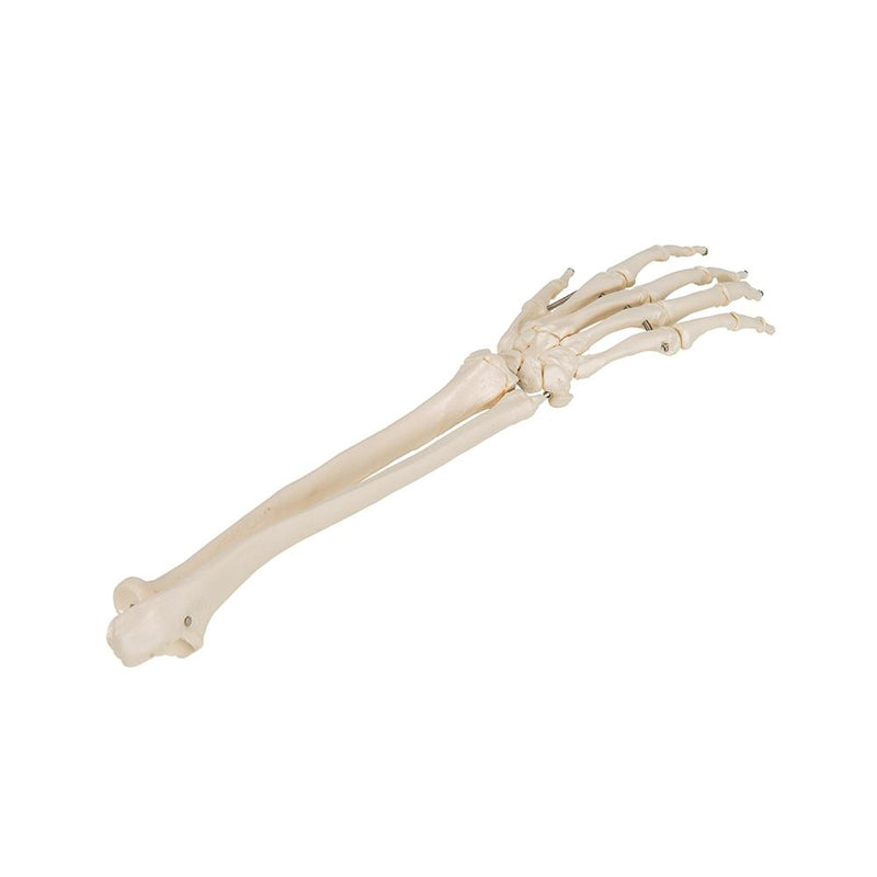 Hand Skeleton with portions of ulna and radius