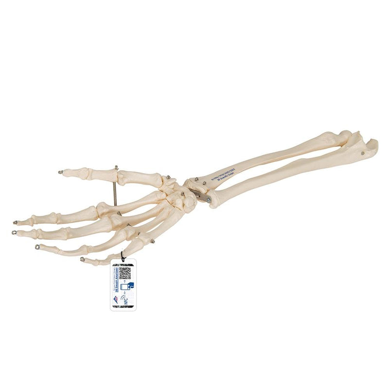 Hand Skeleton with portions of ulna and radius