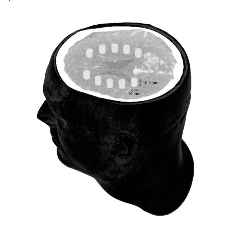 CTA AVM / lesion Head and Neck Phantom for CT Scan and X-Ray Training