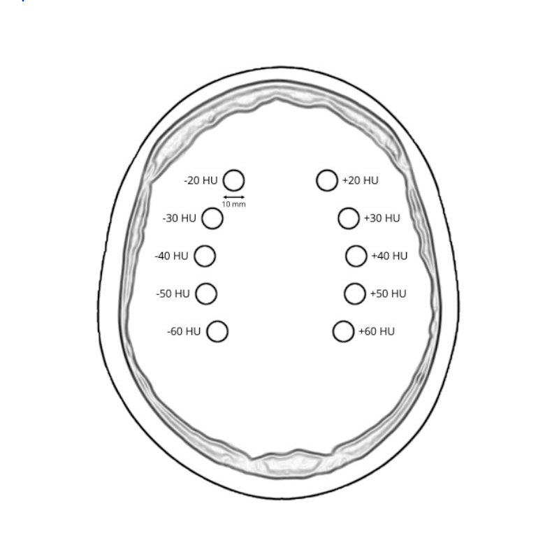 CTA AVM / lesion Head and Neck Phantom for CT Scan and X-Ray Training