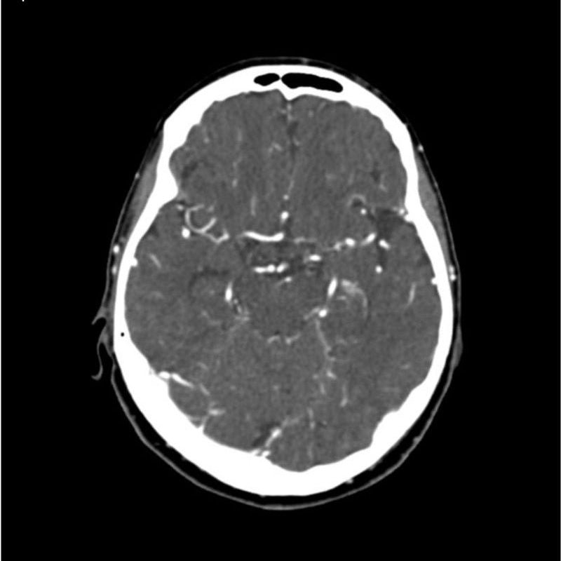 Neck Phantom CTA Head and Neck Phantom for CT Scan and X-Ray Training – GTSimulators.com