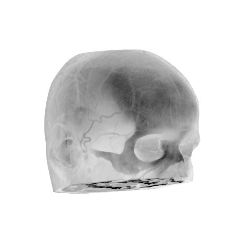 CTA Head Phantom for CT Scan and X-Ray Training