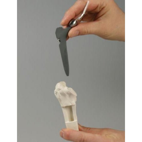 Hip Implant Model