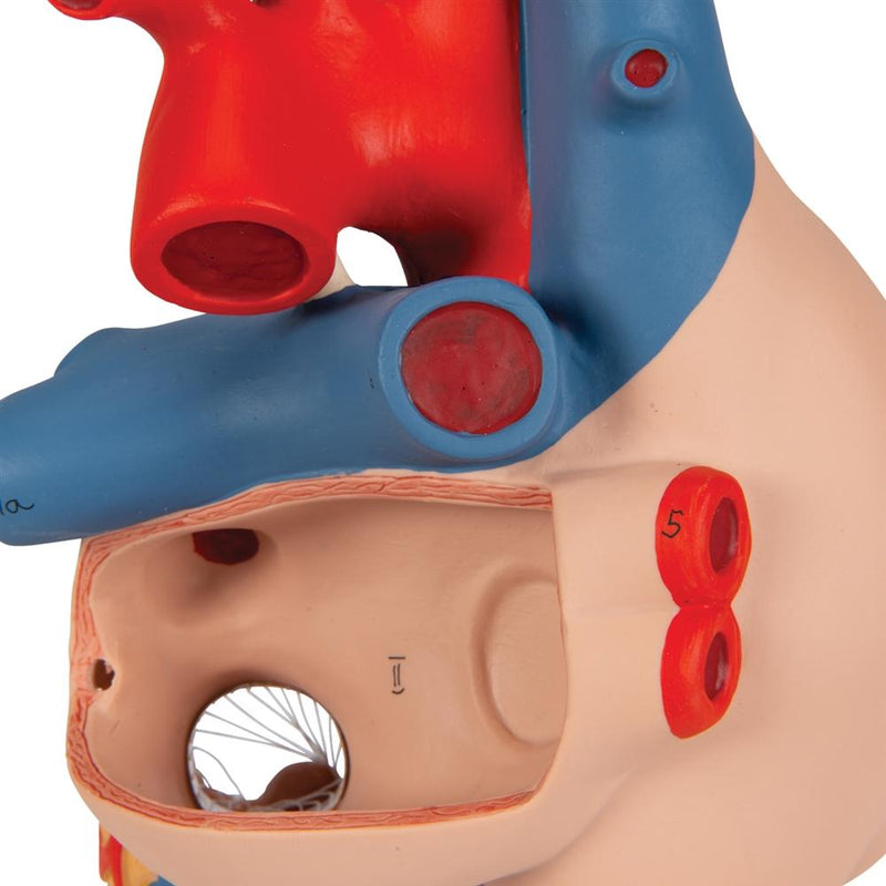 Human Heart Model with Venal Bypass, 2x life-size, 4 part