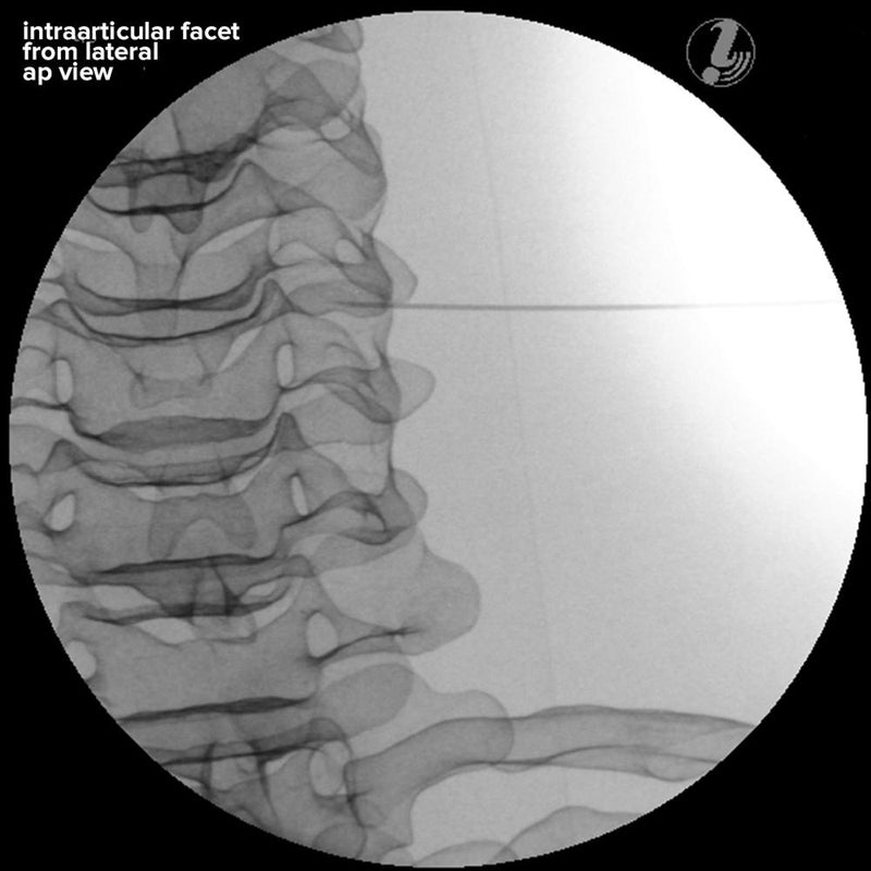 Image Guided Cervical Spine Injection Trainer