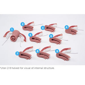 Internal Pathologies Uteri Package