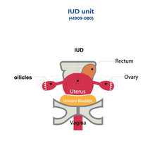 IUD Unit