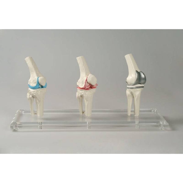 Knee Implant Model – GTSimulators.com