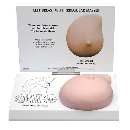 Left Breast Cancer Model, Life-like