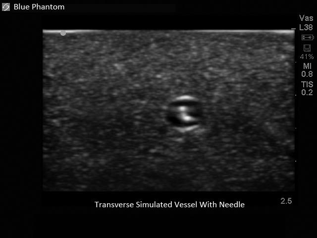 Leg Femoral and Saphenous Vein Venous Access Ultrasound Training Model