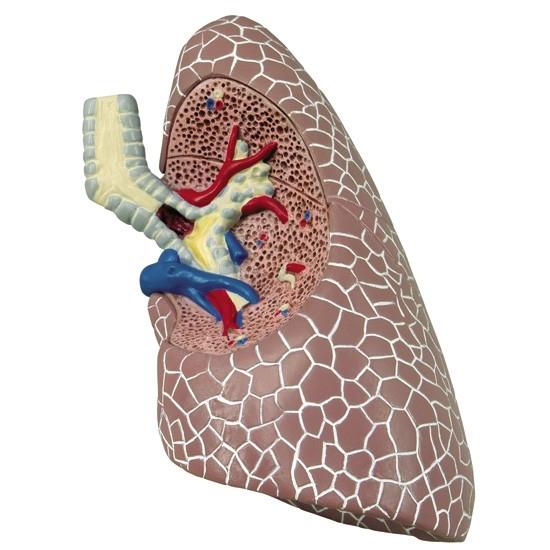 Module Lung Lung Set Model with Pathologies – GTSimulators.com
