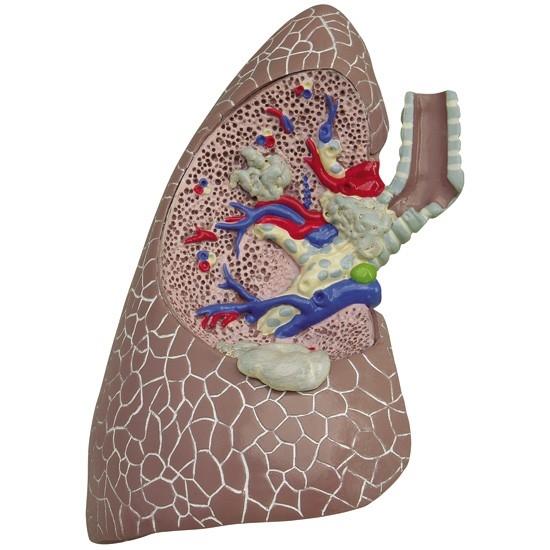 Lung Set Model with Pathologies