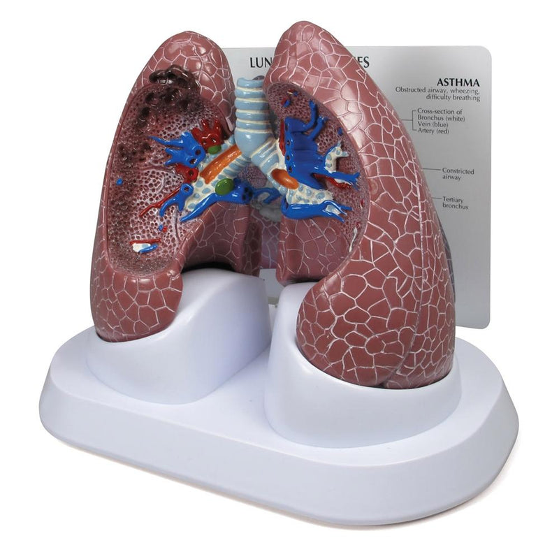Lung Set Model with Pathologies