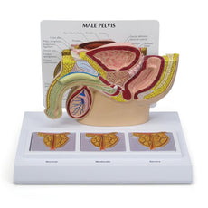 Male Pelvis with 3D Prostate Frame