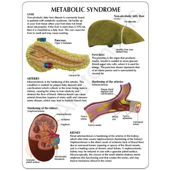 Metabolic Syndrome Model